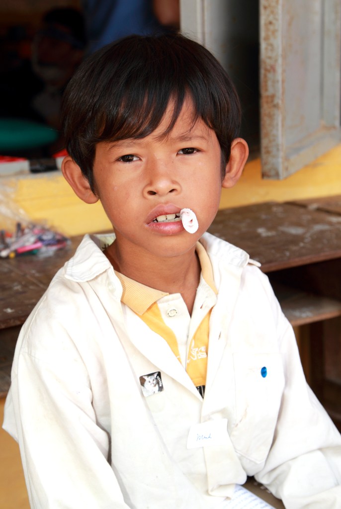 A young boy with black hair sitting outside, wearing a white shirt and a yellow undershirt. He has a piece of plastic in his mouth and looks directly at the camera.